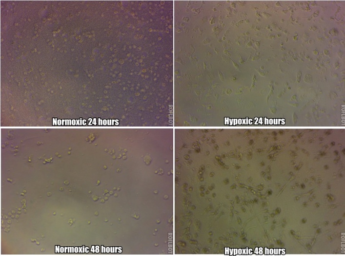 Figure 2-5 - Ahmed