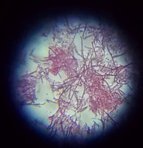 Garg, Jana, Rai, Wu Fig. L: Results from the Gram staining show that the bacteria are Gram-negative.