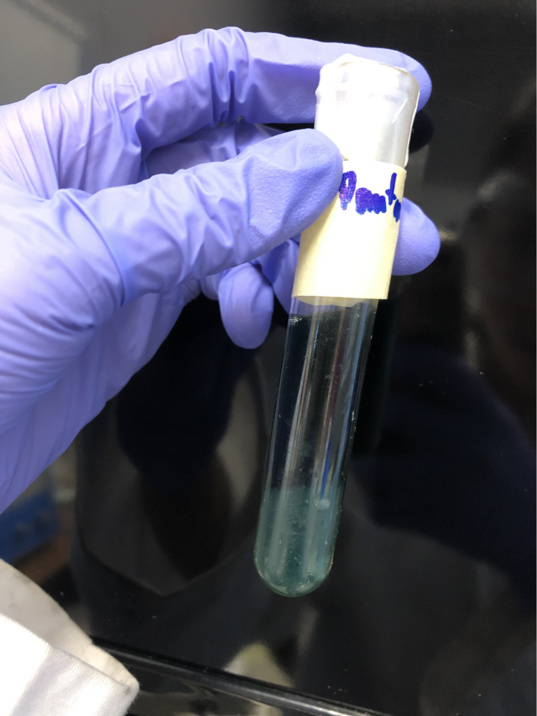 Garg, Jana, Rai, Wu Fig. K: Positive result from the Simmon’s Citrate test, showing that citrate was broken down and used.