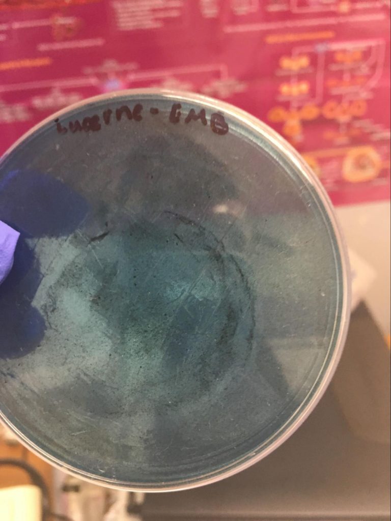 Garg, Jana, Rai, Wu Fig. H: Positive growth of blackish colonies on EMB plate.