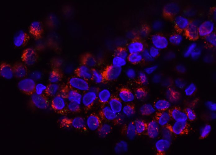 national-cancer-institute-evhLgfOjU5Y-unsplash