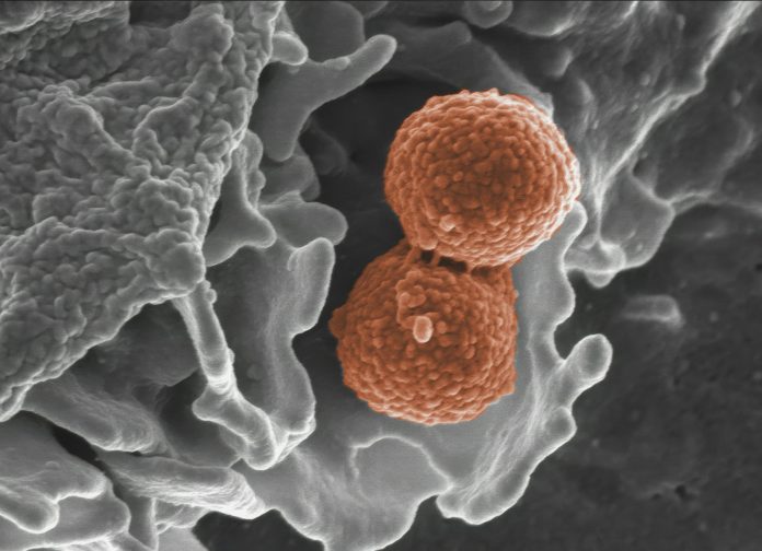 national-institute-of-allergy-and-infectious-diseases-3w-hh7z6BsA-unsplash