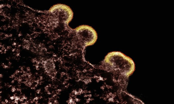 national-institute-of-allergy-and-infectious-diseases-j_vw6h_OT8k-unsplash