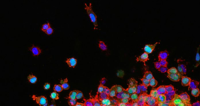 national-cancer-institute-tIqa2uTE8JY-unsplash