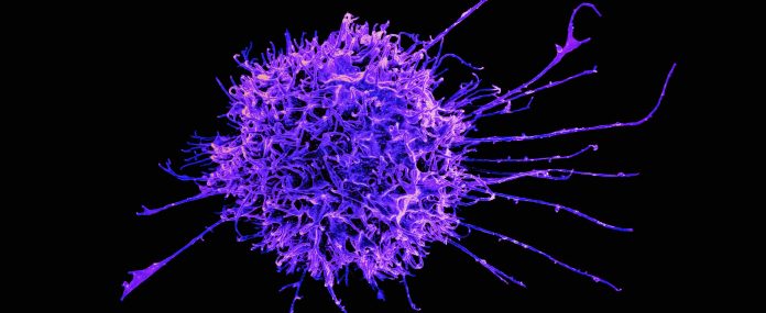 national-institute-of-allergy-and-infectious-diseases-65F0f5Pn80M-unsplash