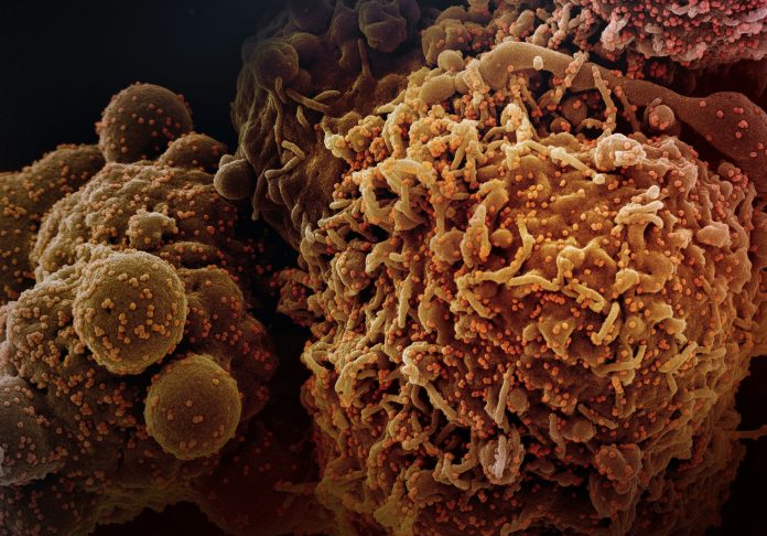 national-institute-of-allergy-and-infectious-diseases-G8EPPoeDd68-unsplash